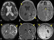 Fig 6.