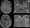 Fig 5.