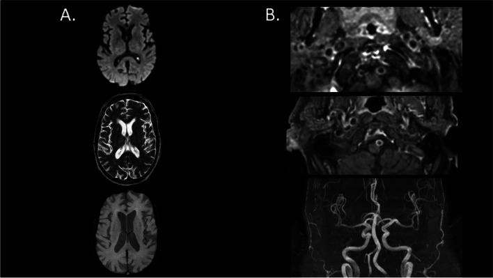 Fig. 2