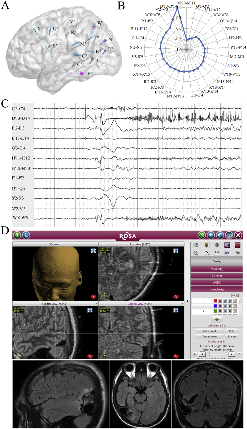 Fig. 4