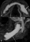 Figure 3 (A,B)