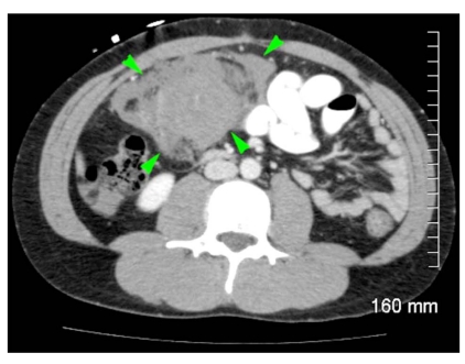 Fig. (1)