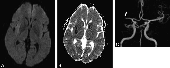 Fig 2.