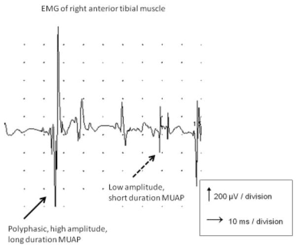 FIG. 3