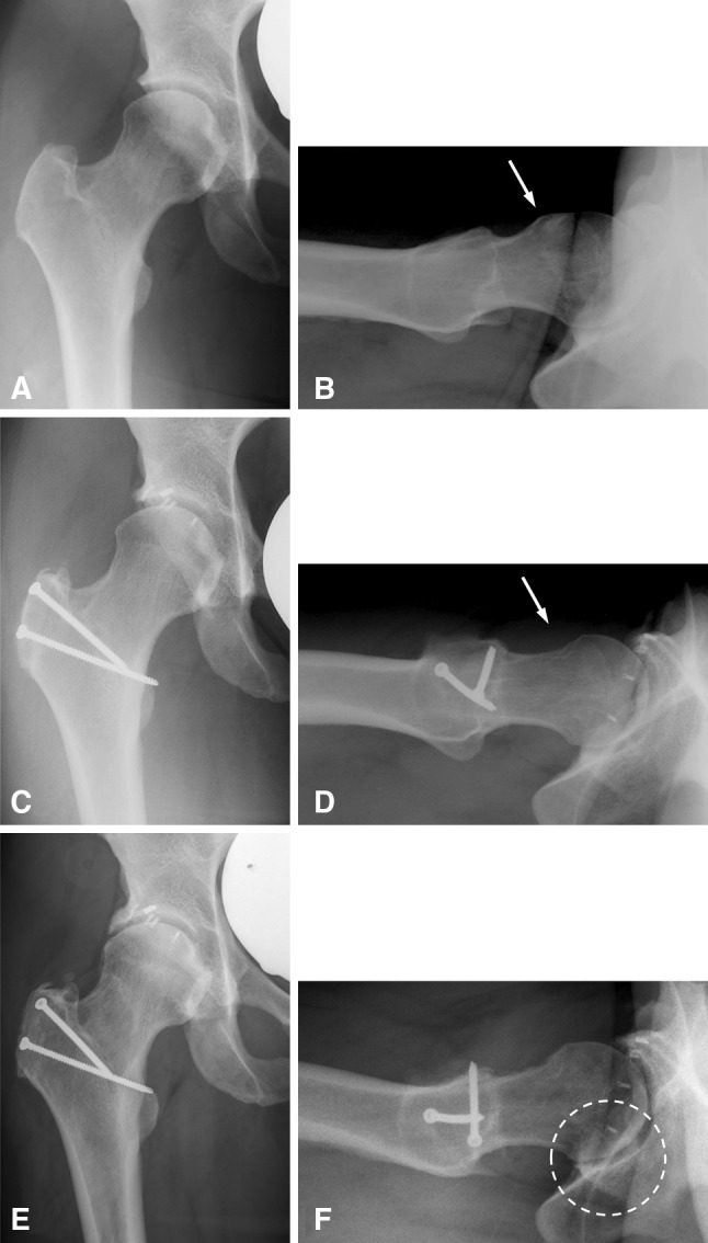 Fig. 4A–F