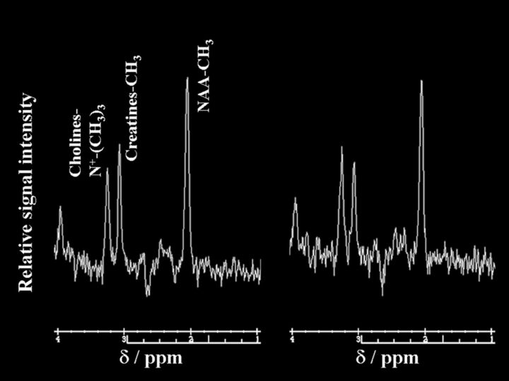 Fig 3.