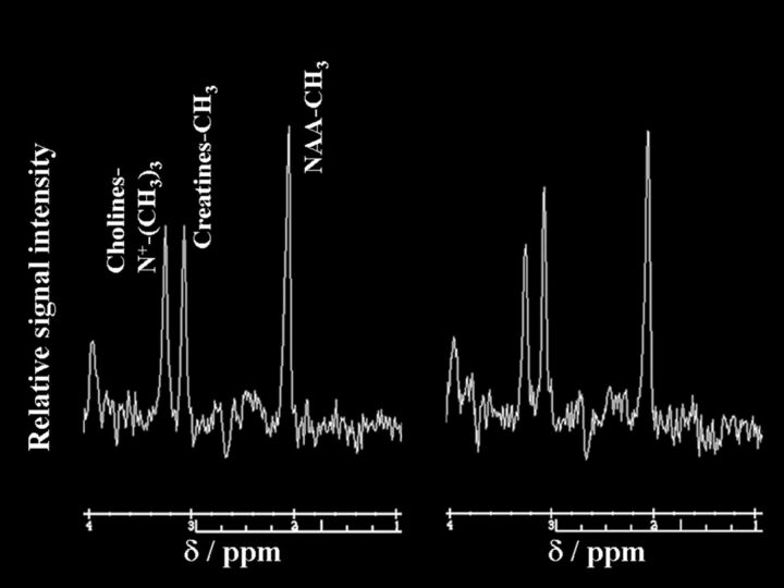 Fig 4.