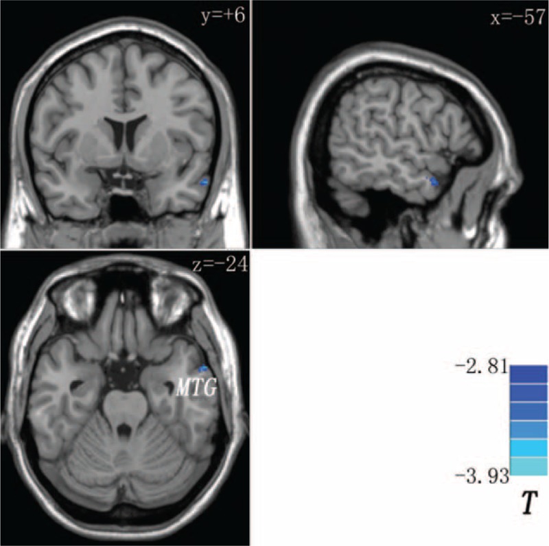 FIGURE 3