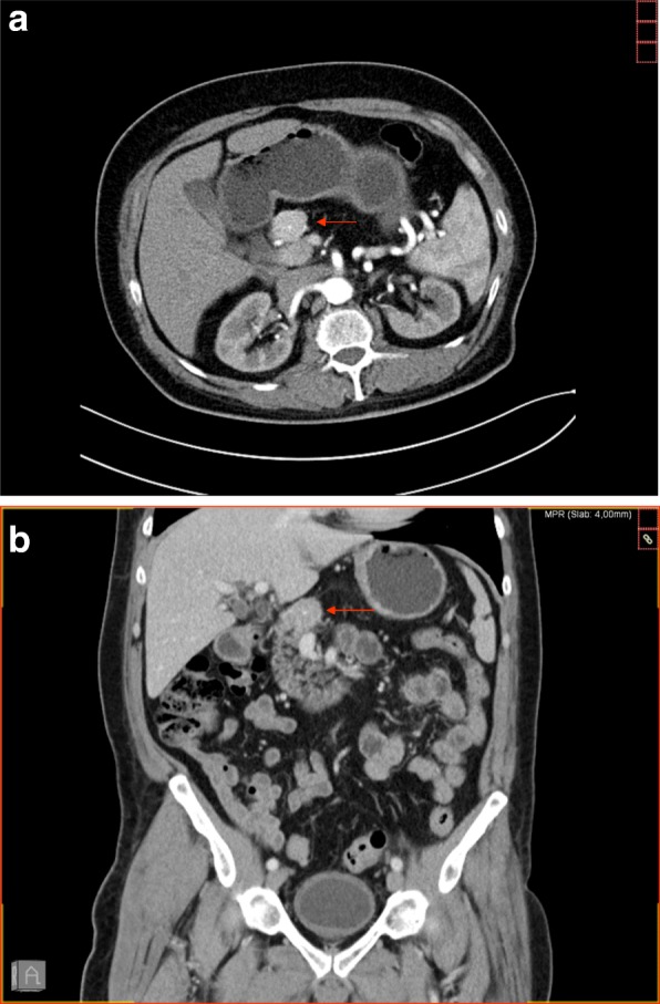 Fig. 1