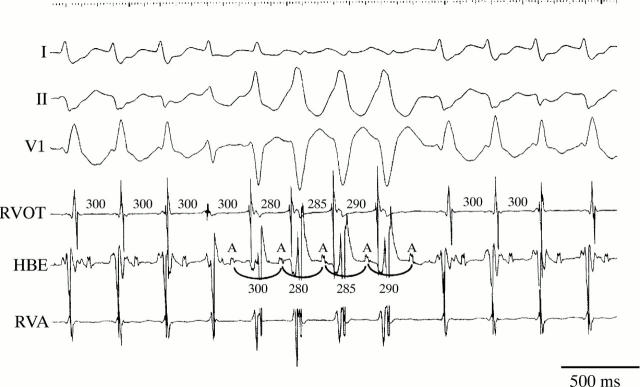 Figure 2  