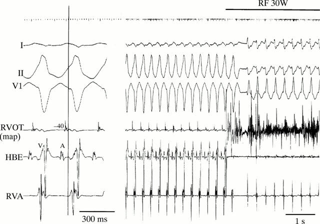 Figure 3  