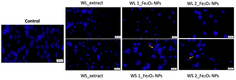 Figure 14