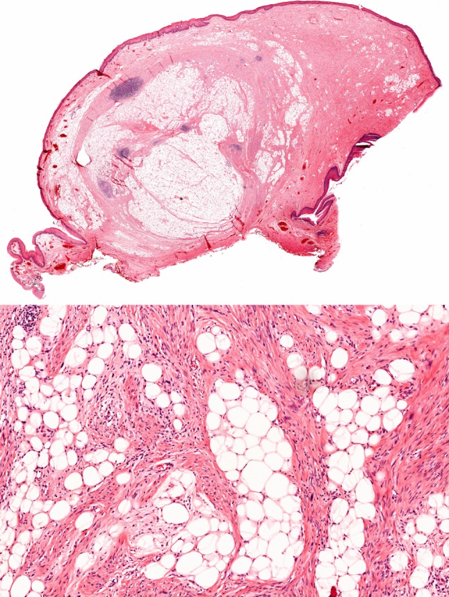 Fig. 1
