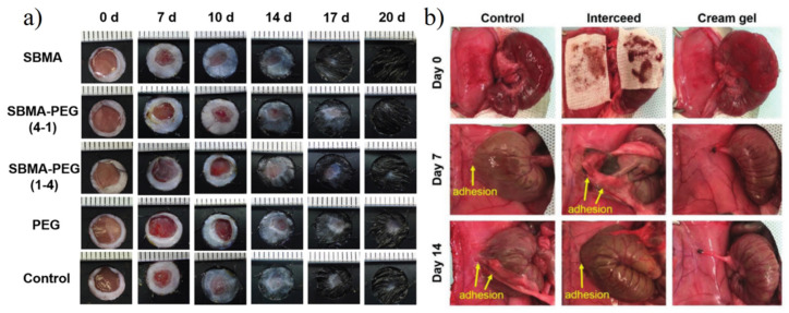 Figure 21