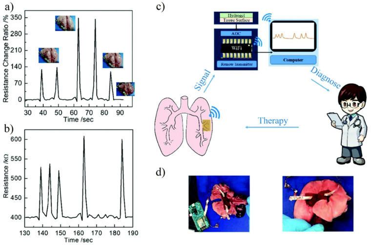 Figure 16