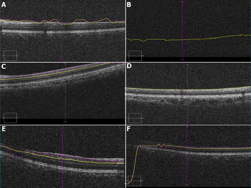 Fig 3