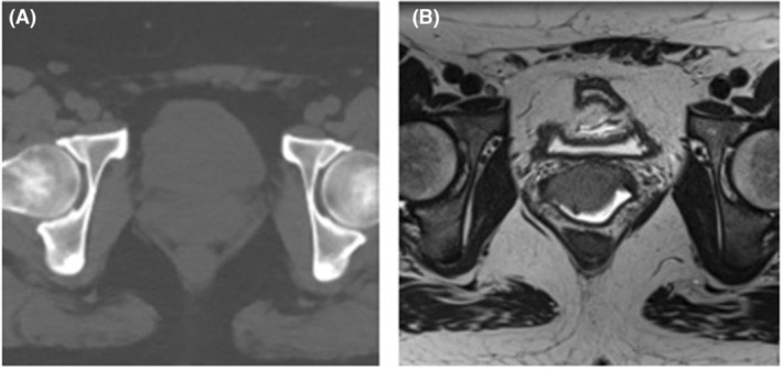 Figure 6