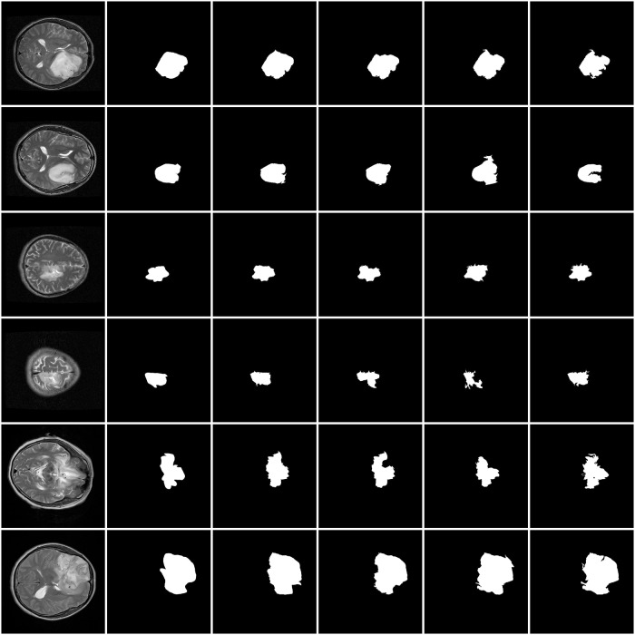 Fig 11