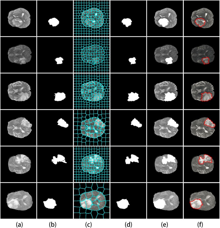 Fig 6