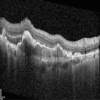 graphic file with name 41598_2021_88543_Figd_HTML.gif