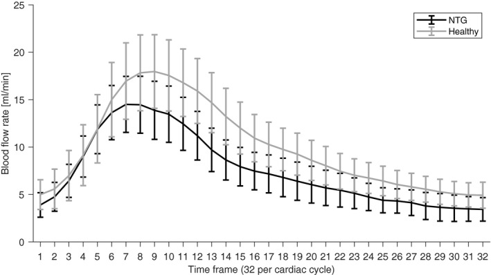 Fig 2