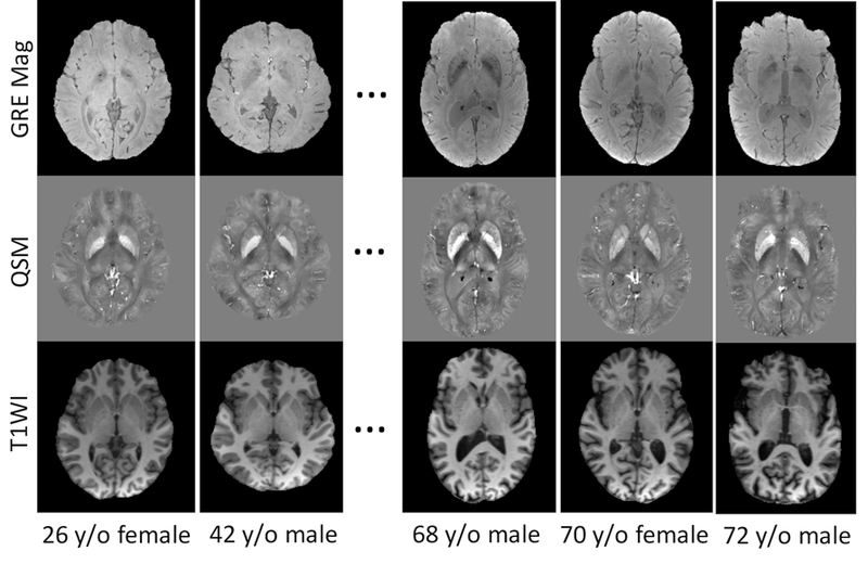 Fig. 1: