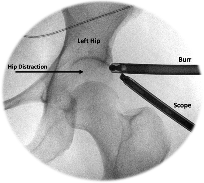 Fig 6