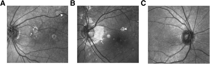 Fig. 2