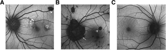 Fig. 3