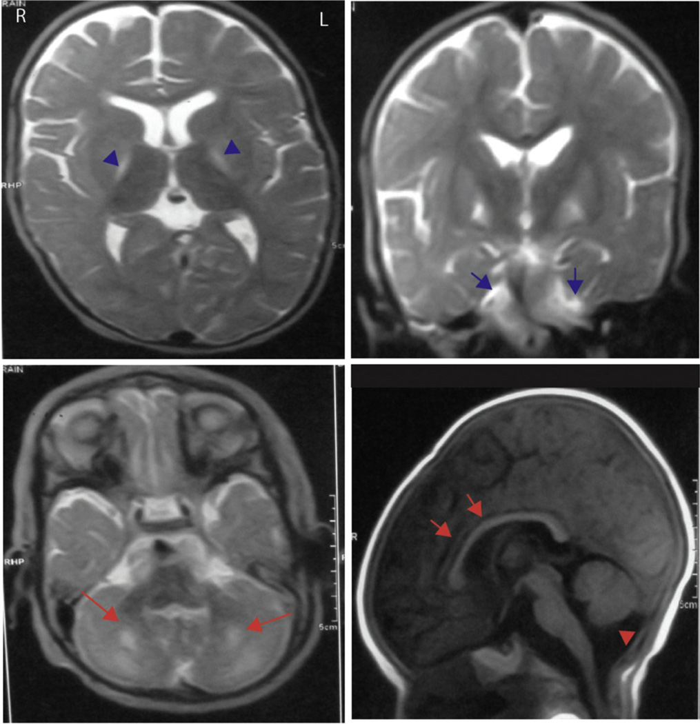 Fig. 3