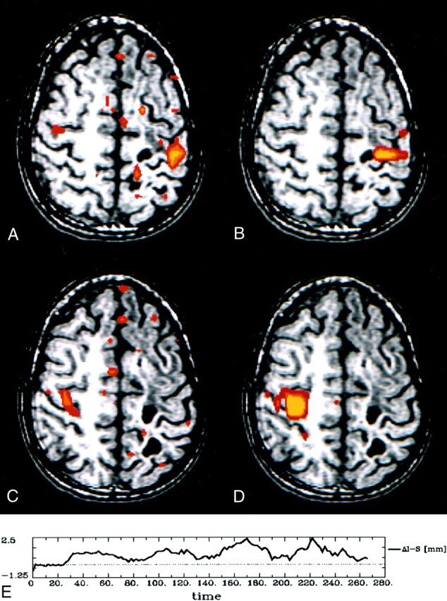 Fig 5.