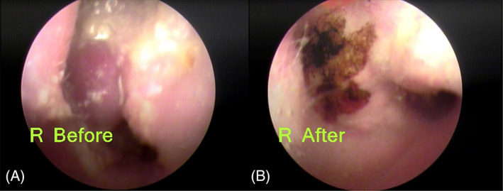 FIGURE 1