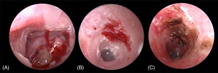 FIGURE 2