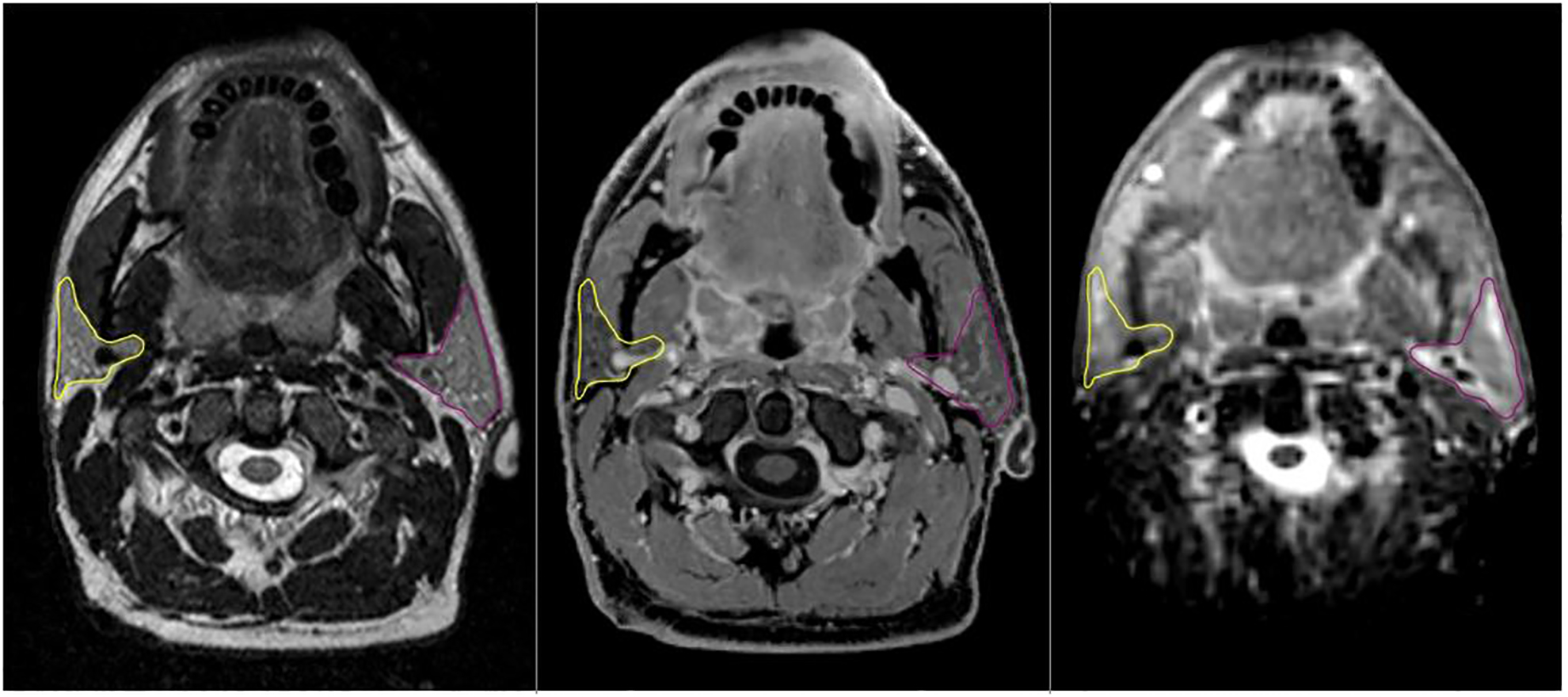 Figure 3: