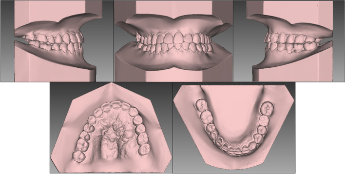 Fig. 12