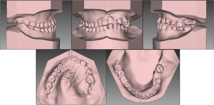 Fig. 5