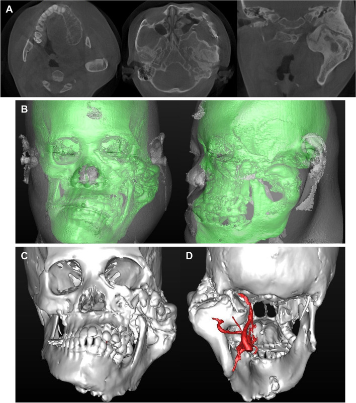 Fig. 2