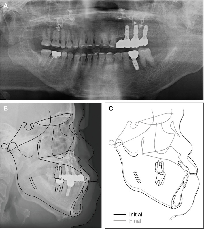 Fig. 13