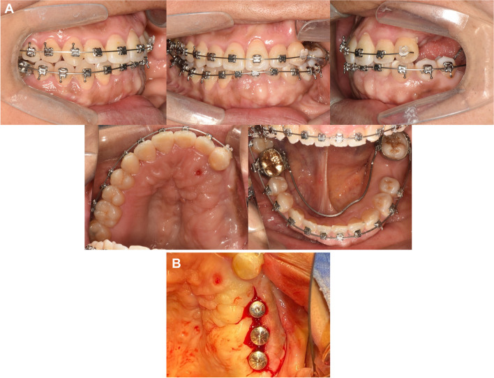 Fig. 10