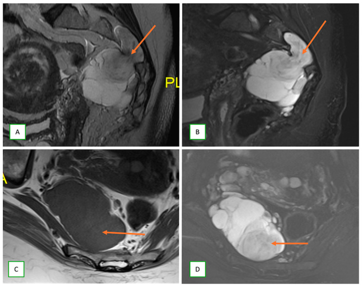 Figure 23