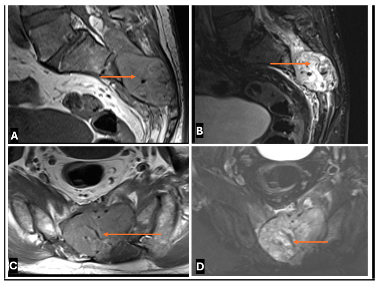 Figure 22