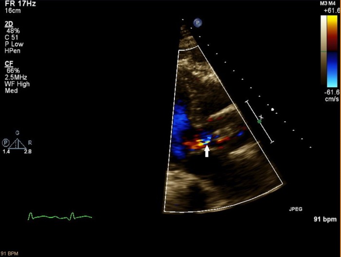 Figure 4