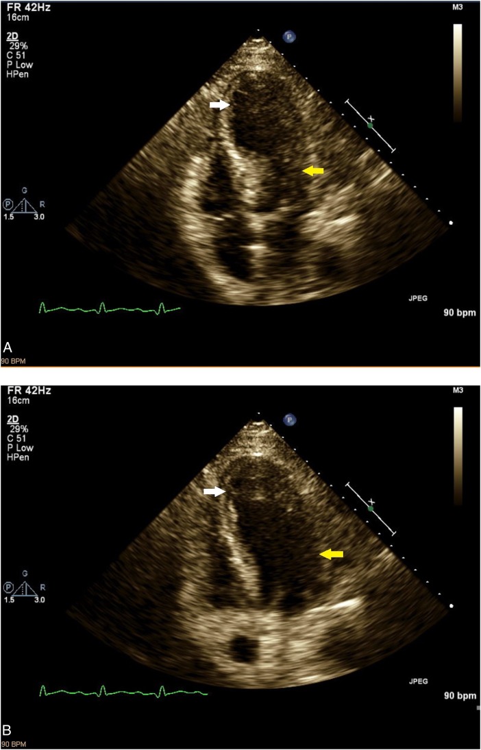 Figure 2