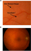 Figure 23.