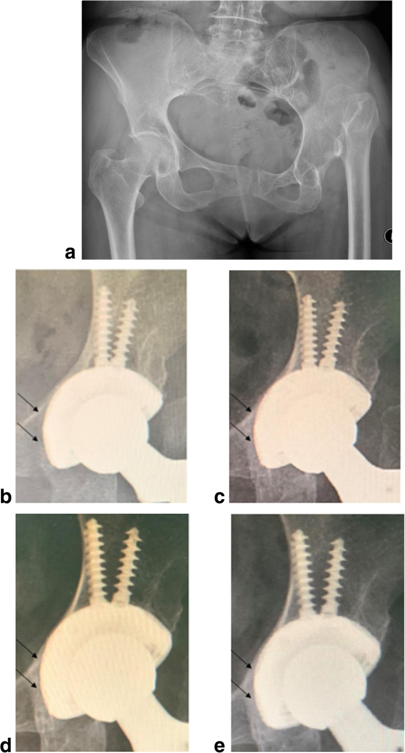 Fig. 5