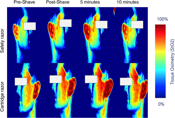 FIGURE 3
