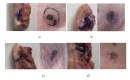 Fig. (11)