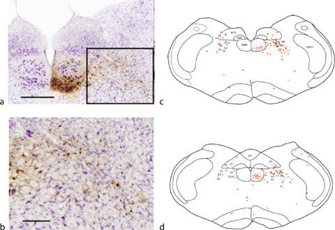 Respiratory Control of Hypoglossal Neurons During Sleep and Wakefulness. Figure 3