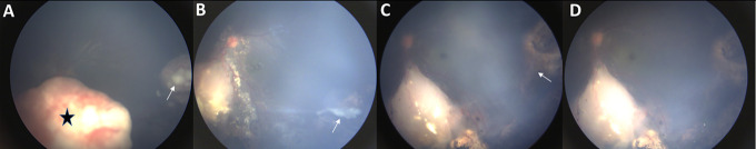 Figure 4.