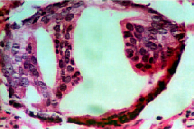 Fig. 1C